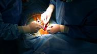 پاورپوینت نحوه بکارگیری وسایل در حین عمل جراحی